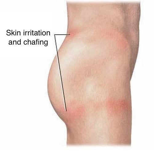 Need help with thigh chafing in this heat. : r/AusSkincare