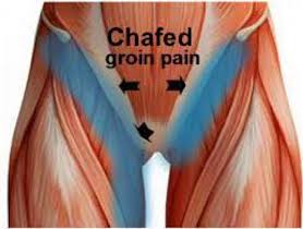 How to Remedy Chafing in Chest and Groin Area?